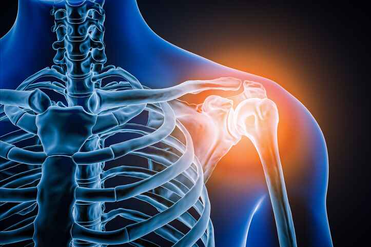 Frozen shoulder condition treated with non-surgical treatment in Lansing MI