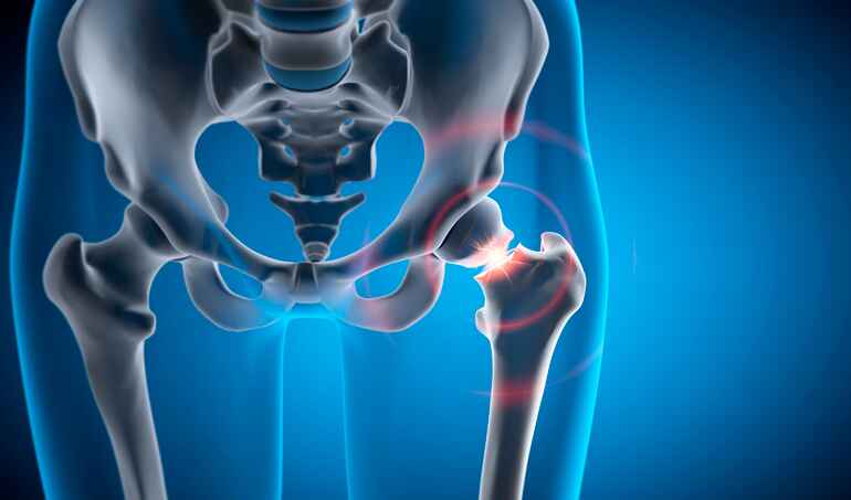Hip Pain Support