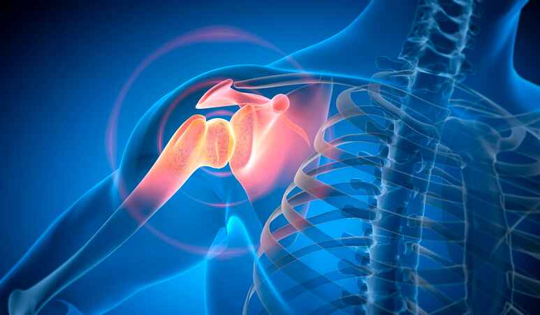 Shoulder Pain Support