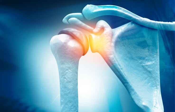 Rotator cuff injury treated with non-surgical shoulder pain treatment in Lansing MI