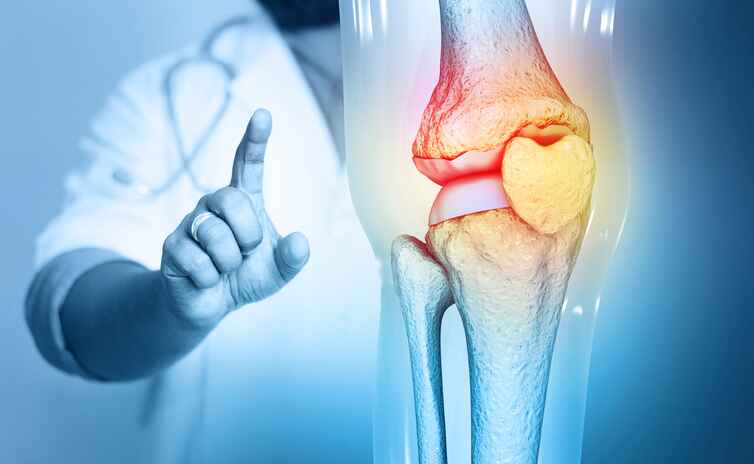 Runners knee condition treated with non-surgical knee pain treatment in Lansing MI